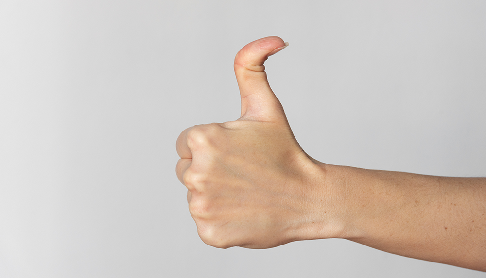 Hand with thumb up, double jointed thumbs, abnormal flexibility.